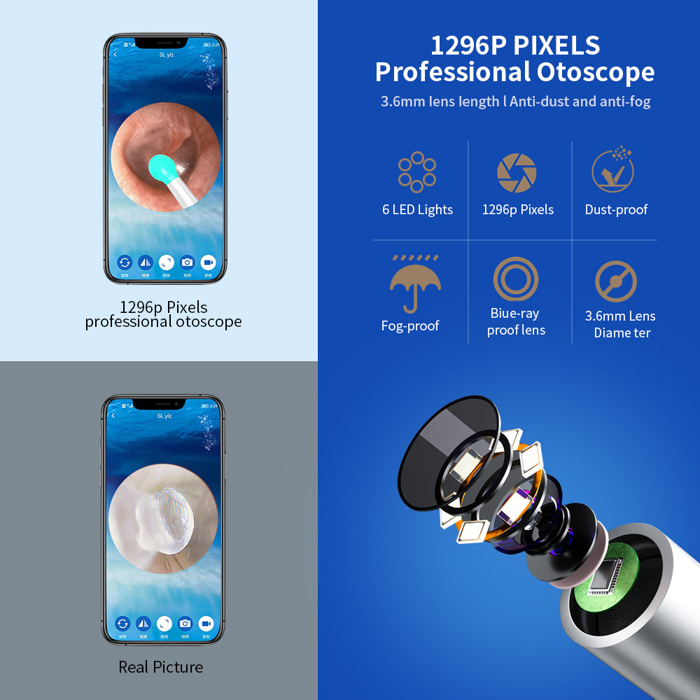 Smart WiFi Ear Camera & Ear Care Tool